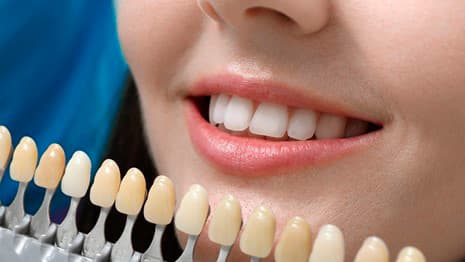 https://prod.tepe.com/globalassets/germany/tepe-share-dach/tepe-share-teeth-whitening.jpg