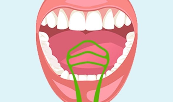About Bad Breath – Wer an Mundgeruch leidet, kann jetzt endlich